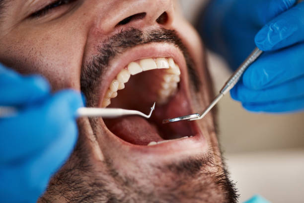 Best Dentist for Tooth Abscess  in Beecher, MI