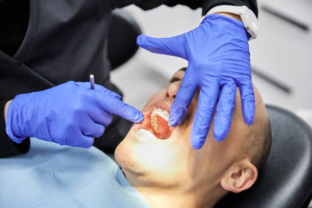Best Emergency Dental Filling Replacement  in Beecher, MI