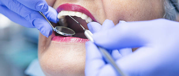 Best Knocked-Out Tooth Emergency  in Beecher, MI